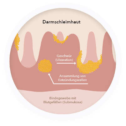 Darmschleimhaut Grafik