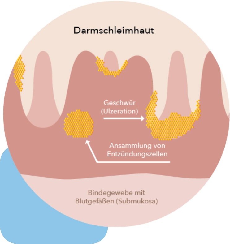 Darmschleimhaut