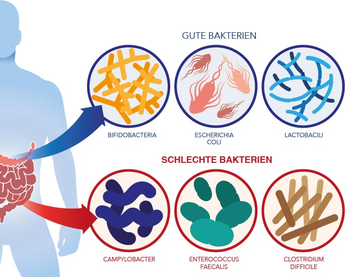 Gute Bakterien - Schlechte Bakterien