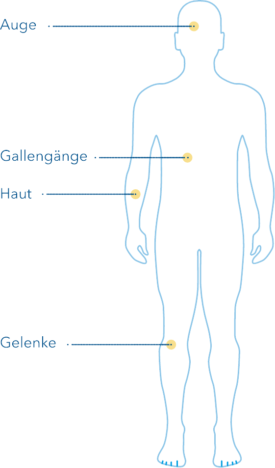 Weitere Beschwerden bei Colitis Ulcerosa